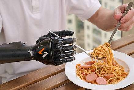 An upper limb young man is using his prothesis hand to hold a fork while the other hand holds a spoon to eat Spaghetti with sausages