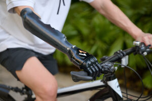 A person using prosthetic hand riding bike