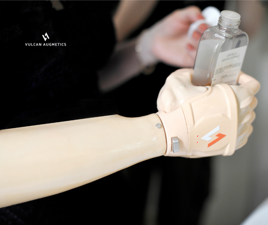 A young arm amputee woman wears a fair skin Vulcan prosthetic hand to hold a skincare bottle in a brown living room