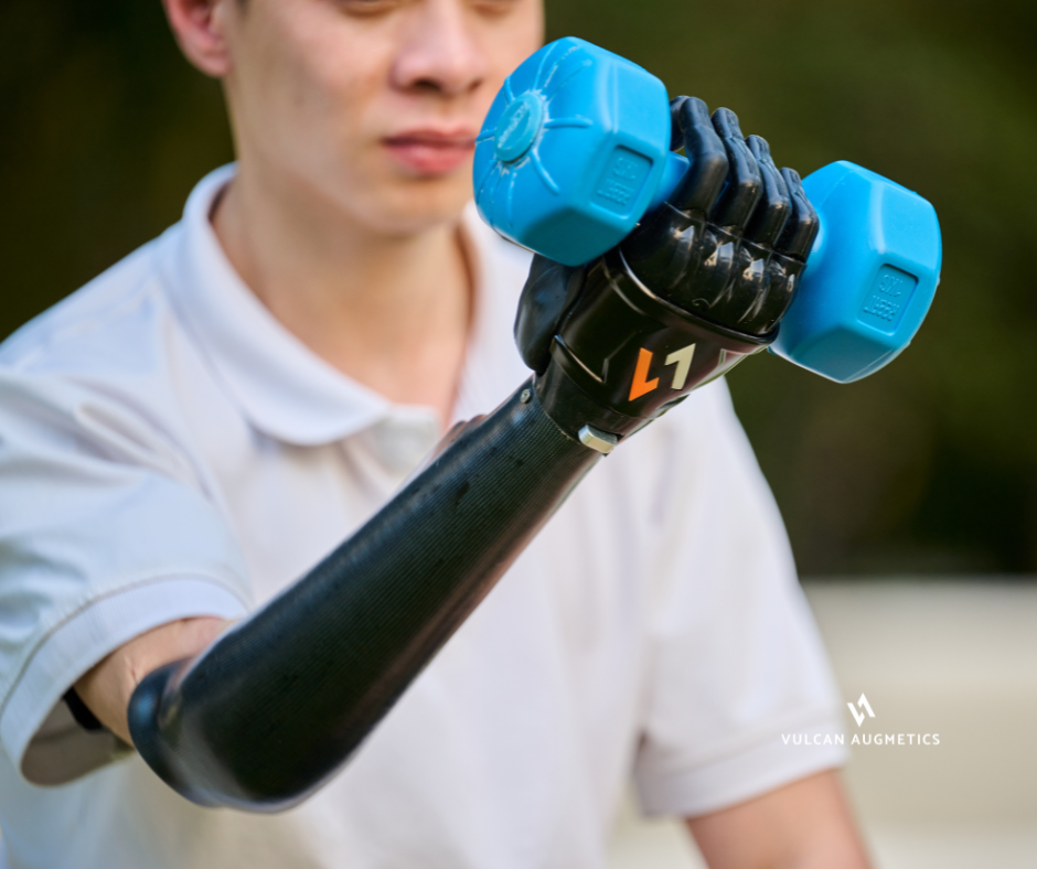 A young arm amputee man wears a black Vulcan prosthetic hand to lift a dumbbell in a park