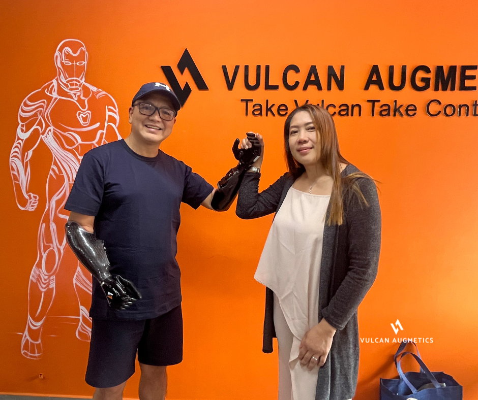 An arm amputee man wearing two black Vulcan prosthetic hands on his both stumps hold his wife's hands in an orange room