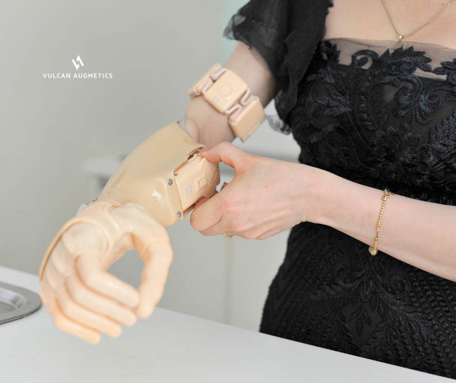 A young female arm amputee wears a fair skin Vulcan prosthetic hand in a kitchen