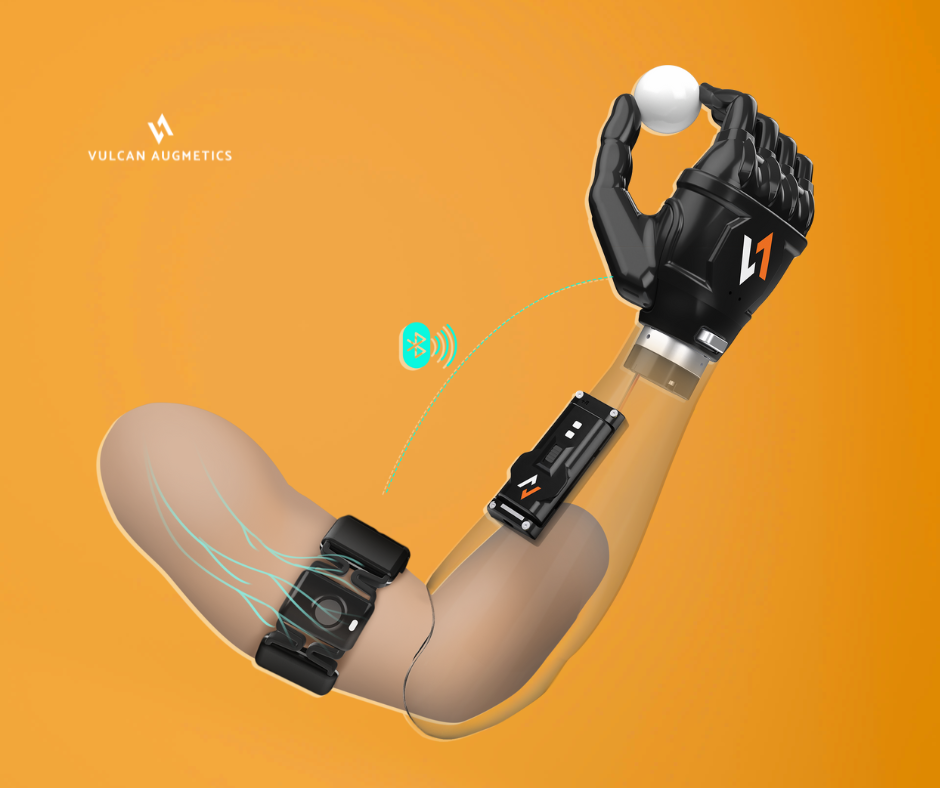 The control technique between Vulcan myoelectric prosthetic hand and the sensor ring