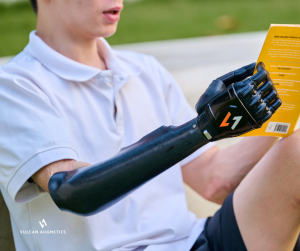 A young male arm amputee wears a black Vulcan prosthetic hand to hold a book