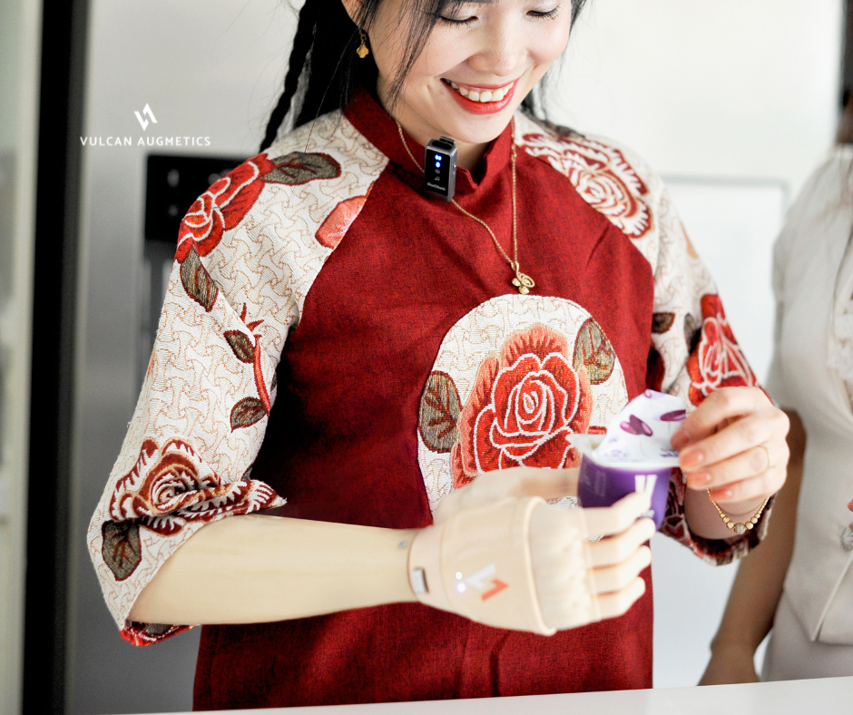 A young female arm amputee wears a fair skin Vulcan prosthetic hand to hold a yoghurt cup in a kitchen